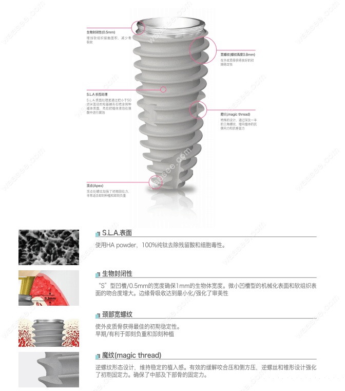 纽百特种植体独特设计优势