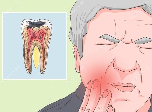 明显的牙齿疼痛症状