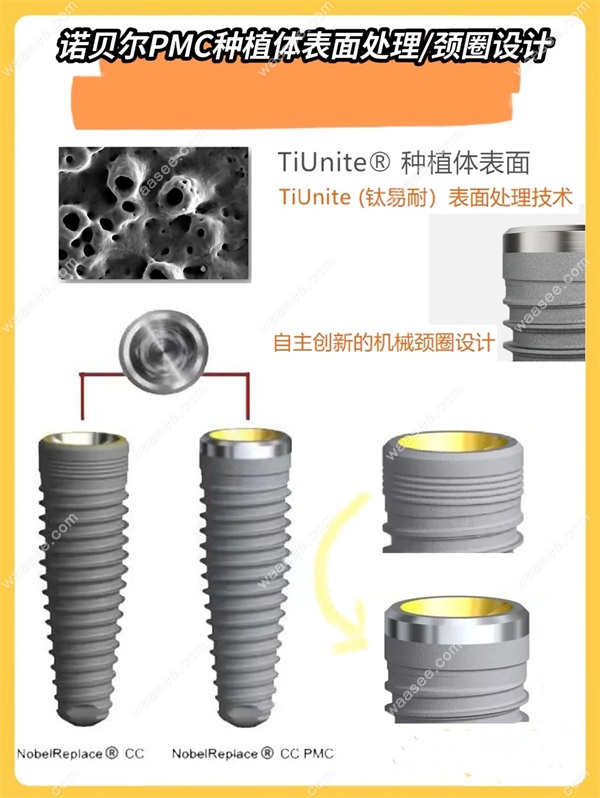 瑞典种植牙多少钱一颗