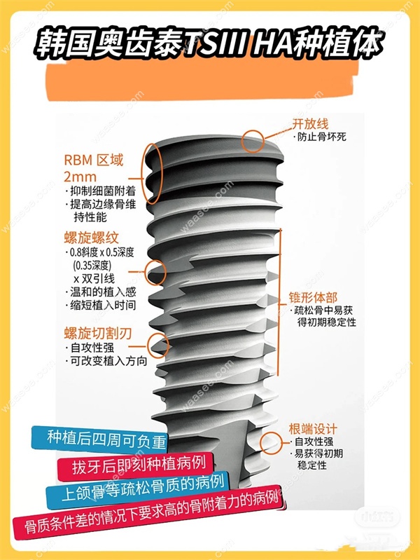 登腾二代和奥齿泰哪个好