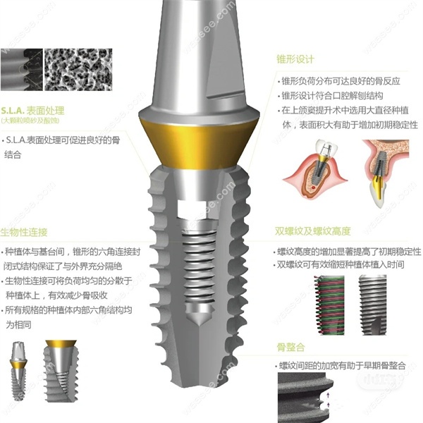 登腾二代和奥齿泰哪个好