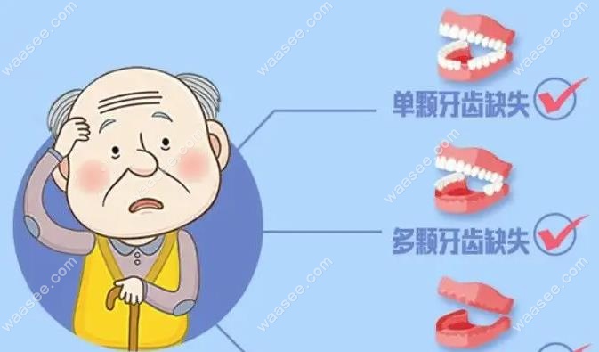 牙齿缺失示意图waasee.com
