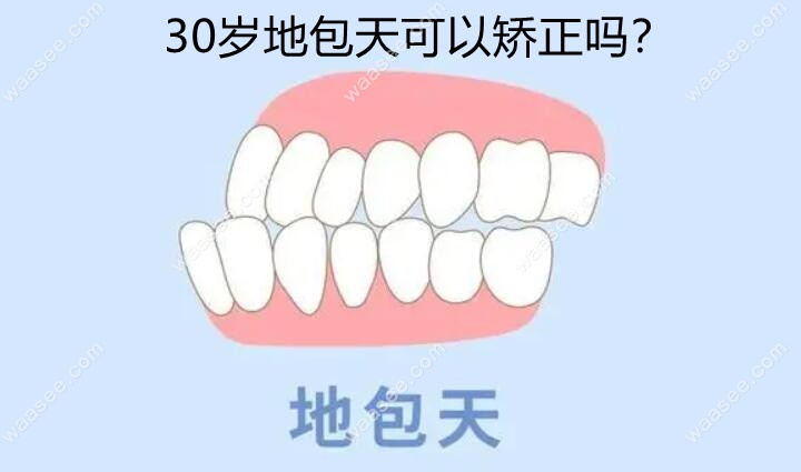 30岁地包天可以矫正吗www.waasee.com