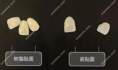 超薄全瓷贴面品牌排行榜前十名单