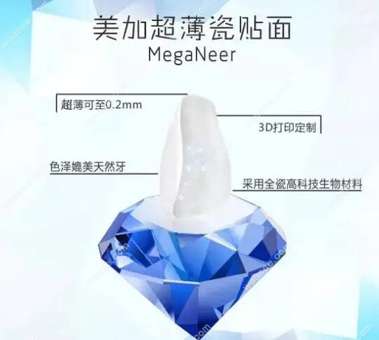 超薄瓷贴面品牌-美加waasee.com