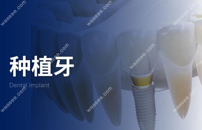 福州维乐口腔种植牙价格是2880元起