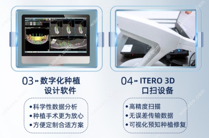 西宁种植牙哪个医院好