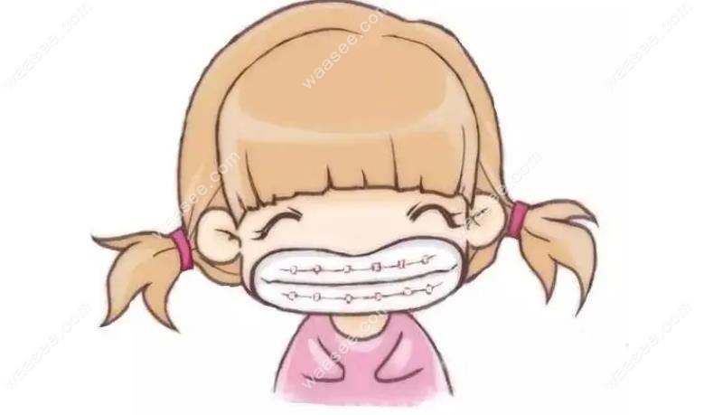 牙齿矫正示意图