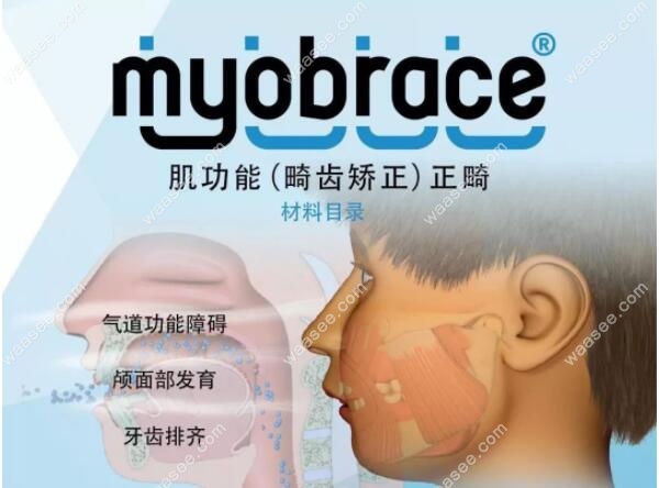 mrc儿童肌功能矫正器价格表