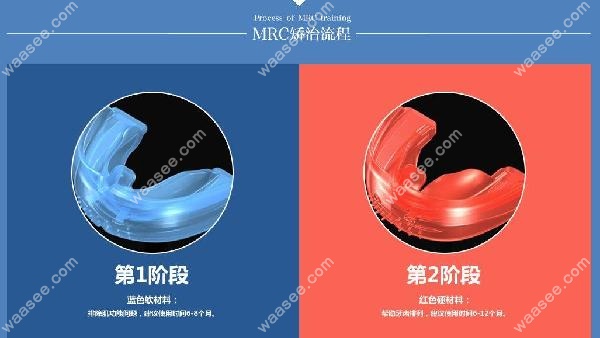 不同阶段的MCR矫正器waasee.com