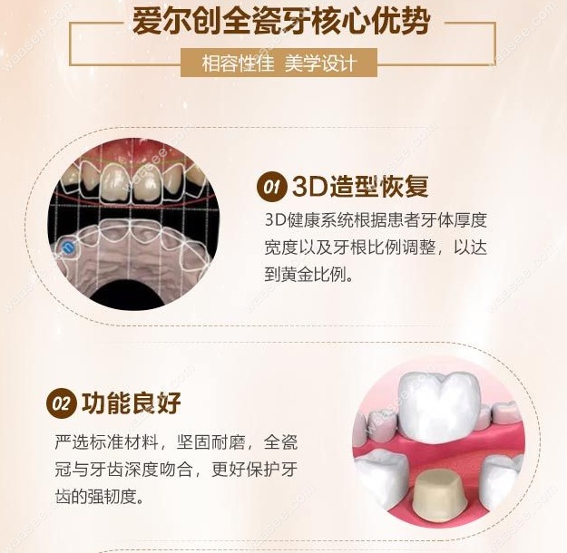 国产爱尔创全瓷牙的优缺点www.waasee.com