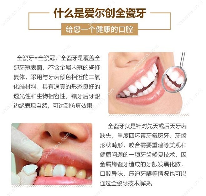 国产爱尔创全瓷牙质量如何