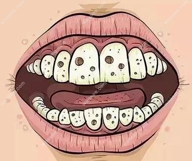 牙菌斑后期图片waasee.com