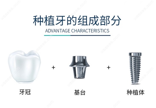 呼和浩特种牙去哪家口腔医院好