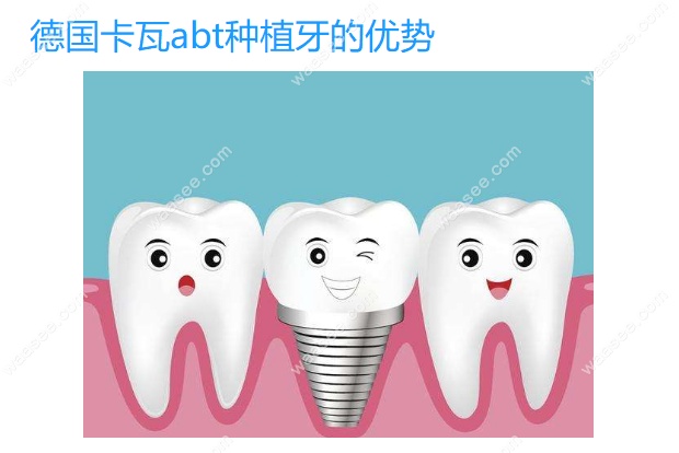 德国卡瓦abt种植体的优势