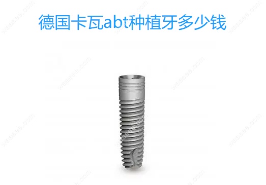 德国卡瓦abt种植牙多少钱