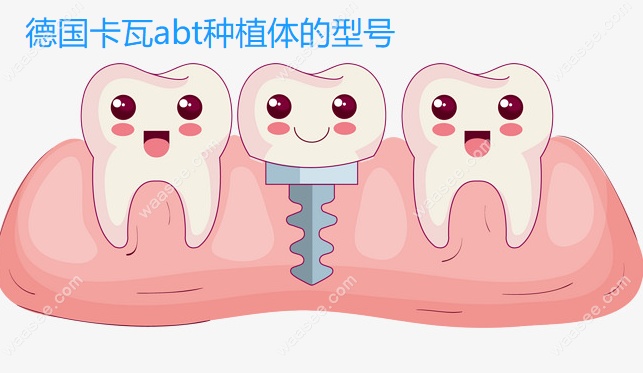 德国卡瓦abt种植体型号www.waasee.com