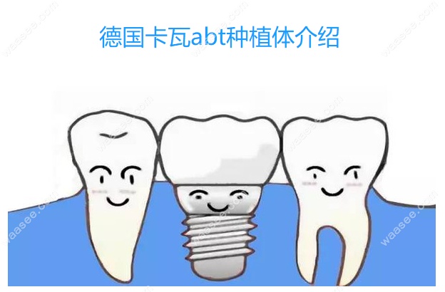 德国卡瓦abt种植体介绍