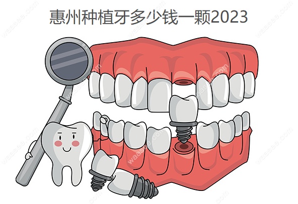 惠州种植牙多少钱一颗2025年