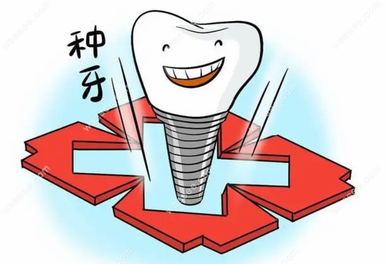北京佳美口腔种牙价格waasee.com