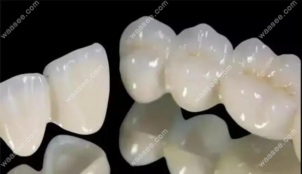 牙博士口腔全瓷牙收费