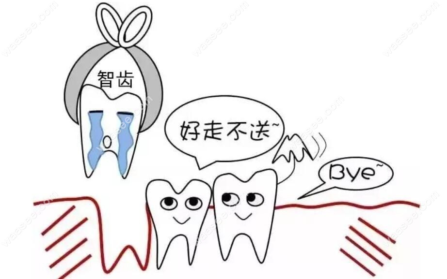 如果智齿发炎也可以拔智齿