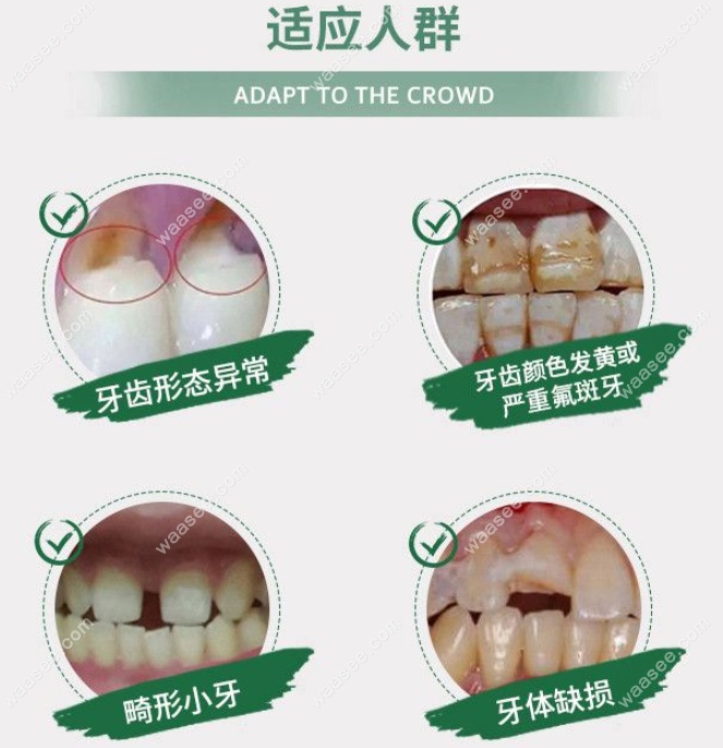 周口镶牙要多少钱一颗
