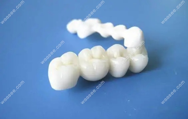 海涛口腔镶牙多少钱？