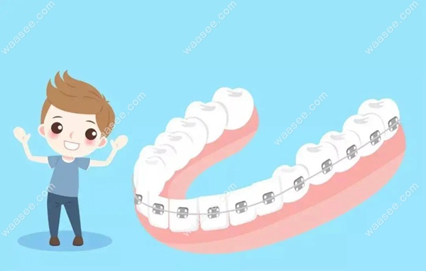 正夫口腔正畸费用www.waasee.com