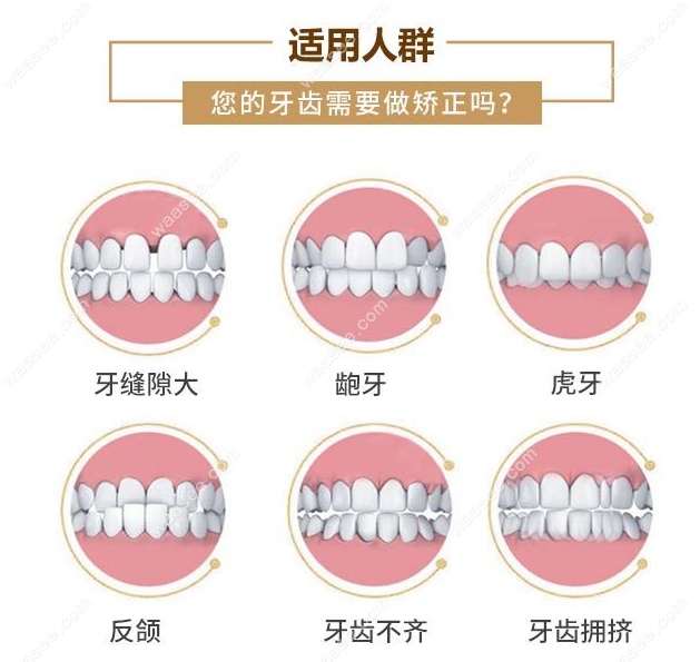 时代天使comfos是什么版