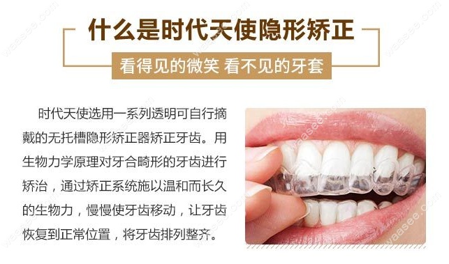 时代天使隐形comfos的卖点www.waasee.com