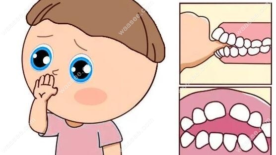 西安三甲医院做儿童矫正牙齿比较好是西安交大口腔科