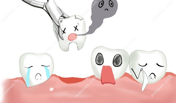 华西口腔拔智齿www.waasee.com