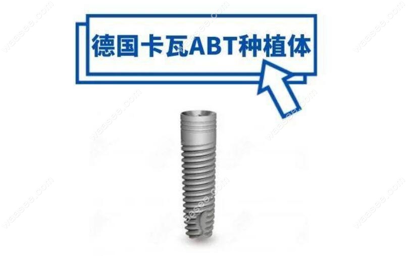 德国ABT种植体怎么样
