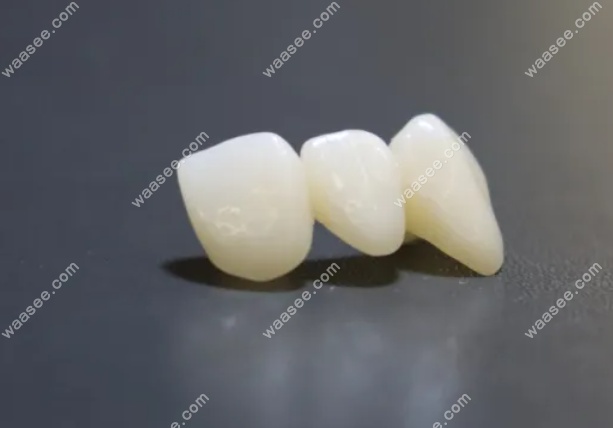 瑞典procera全瓷牙中文名叫