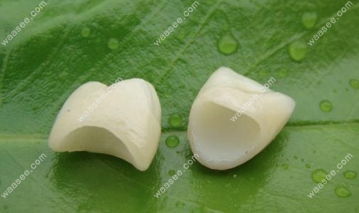 爱尔创全瓷牙优势www.waasee.com