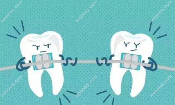 武大口腔金属矫正价格waasee.com