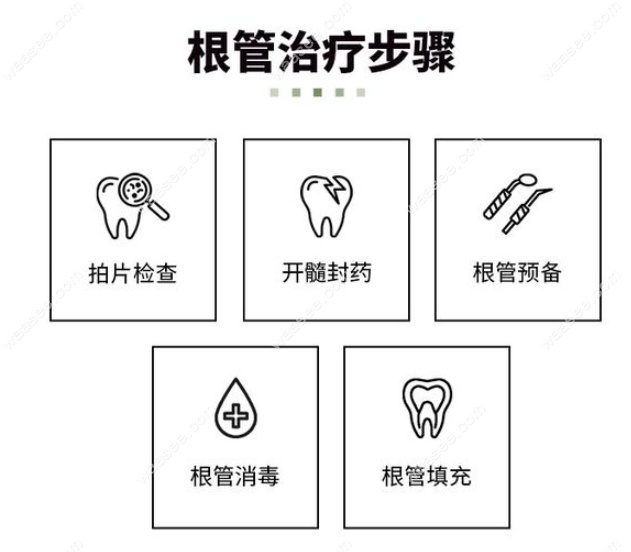 根管治疗收费标准明细