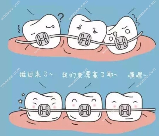 矫正牙齿6000块可靠吗