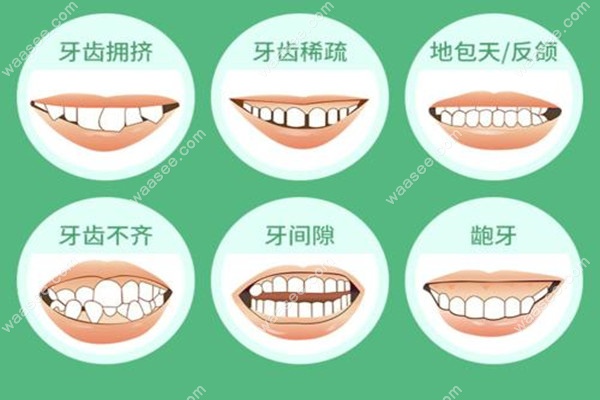 可矫正的畸形牙类型waasee.com