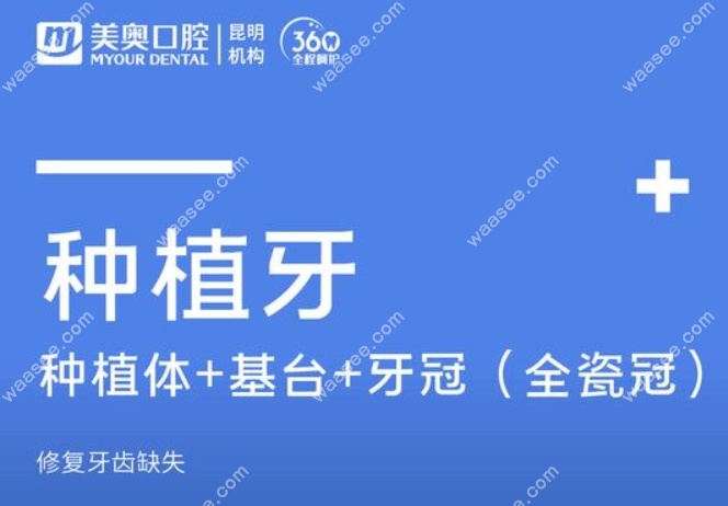昆明种植牙2980元预约