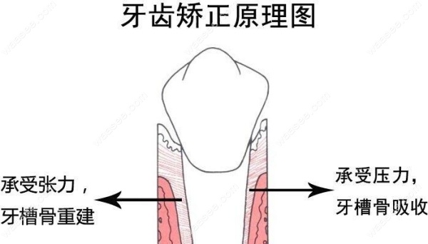 长沙时代天使隐形矫正价格