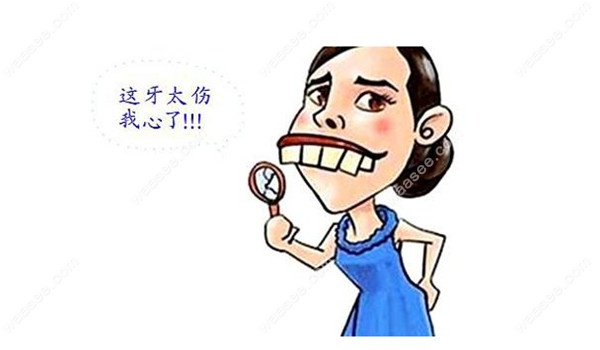 时代天使重启为什么要5000元