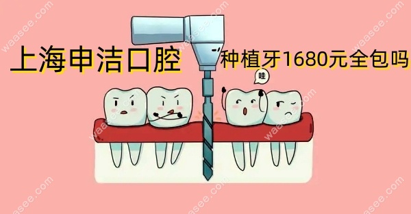 上海申洁口腔种植牙1680元全包吗waasee.com