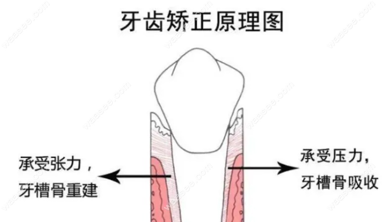 二次矫正牙齿的弊端www.waasee.com