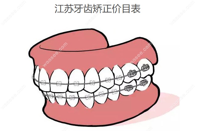 江苏牙齿矫正价目表www.waasee.com