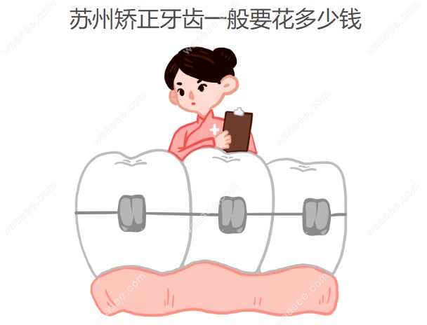 苏州矫正牙齿一般要花多少钱