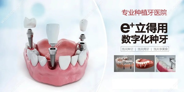 郑州中诺口腔医院种植牙优势