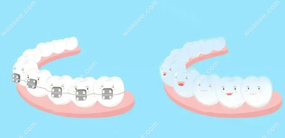 南京金铂利口腔牙齿矫正价格表www.waasee.com