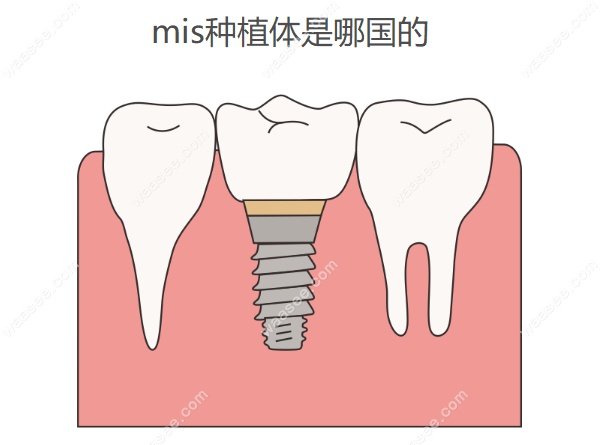 mis种植体是哪国的www.waasee.com